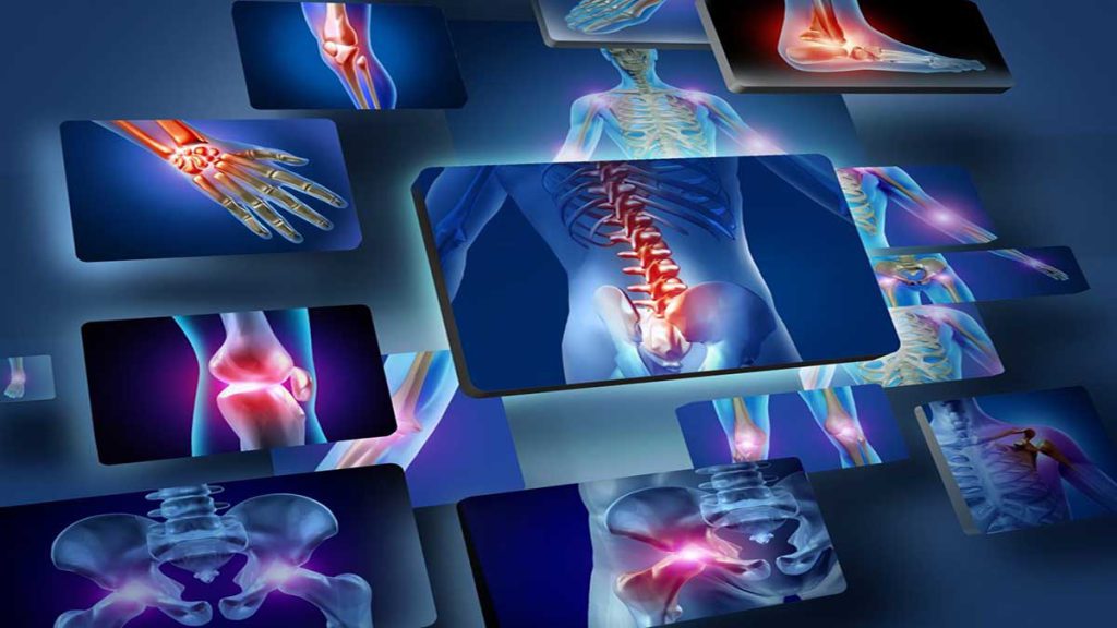 نشانه های فیبرومیالژیا