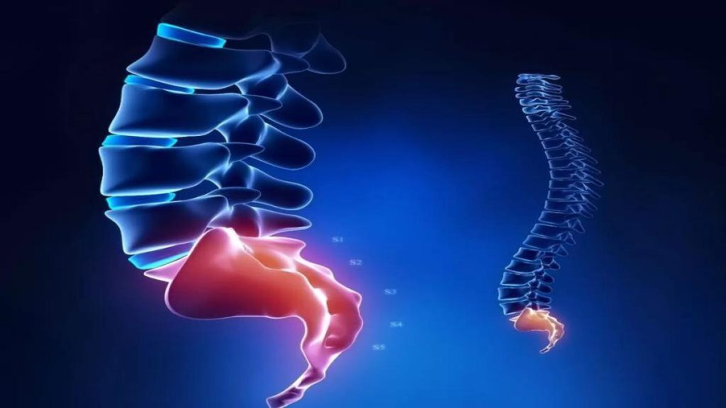 درمان دنبالچه با انگشت درمان دنبالچه با انگشت