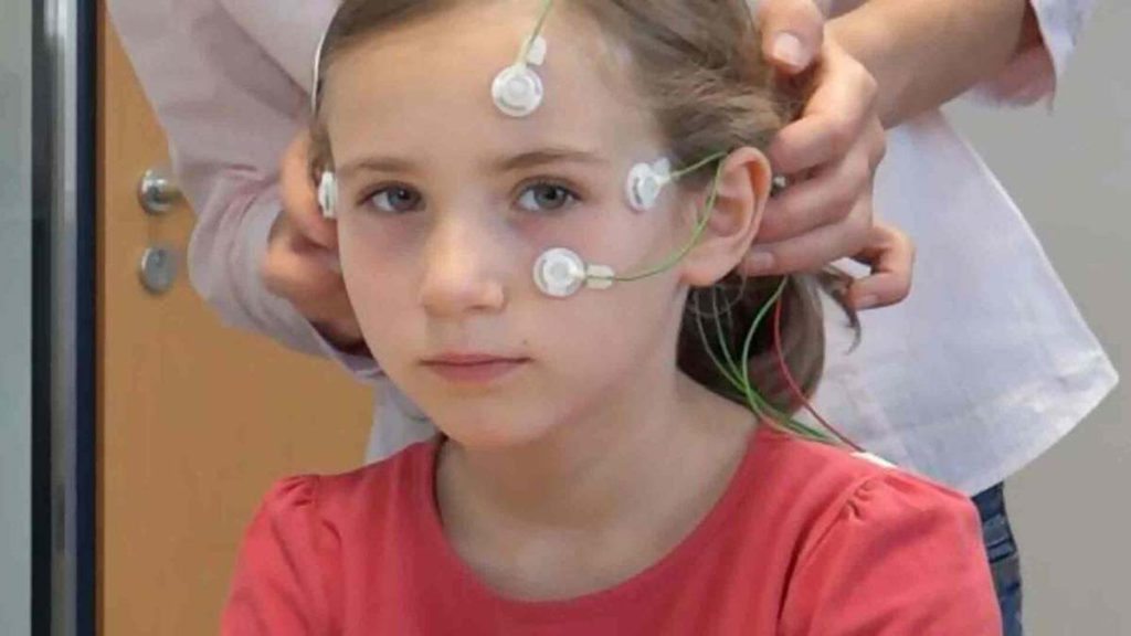 نوار عصب صورت برای کودکان