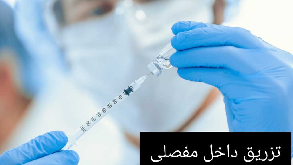 پزشک در حال آماده سازی سرنگ برای تزریق داخل مفصلی