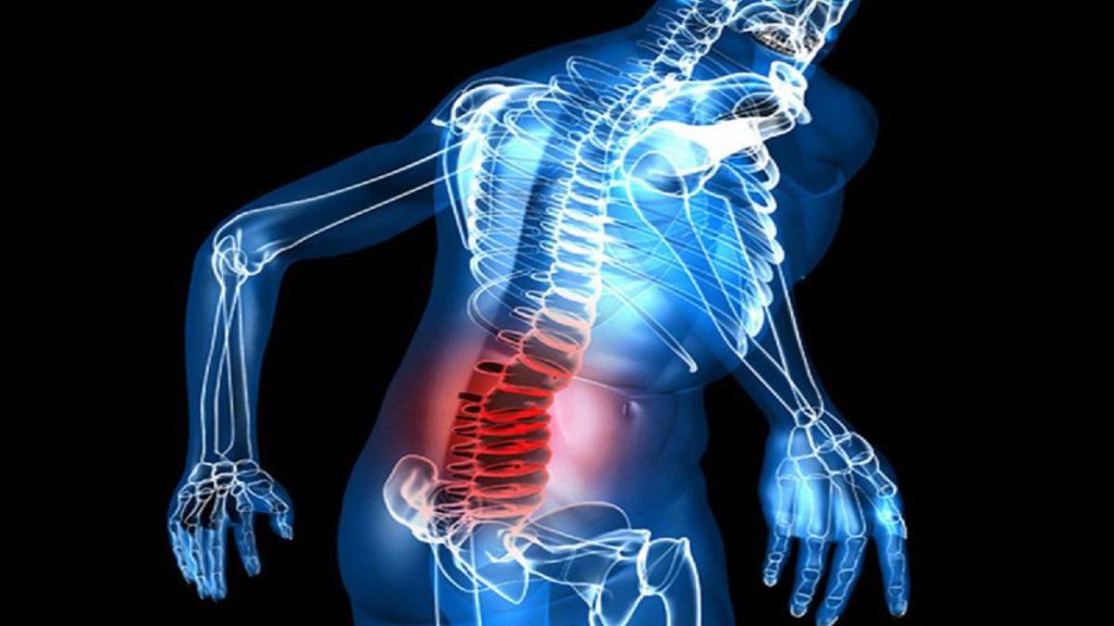 تزریق ژل ازون و کورتون به دنبالچه