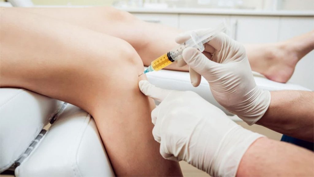 بیماری که پی آر پی انجام می دهد