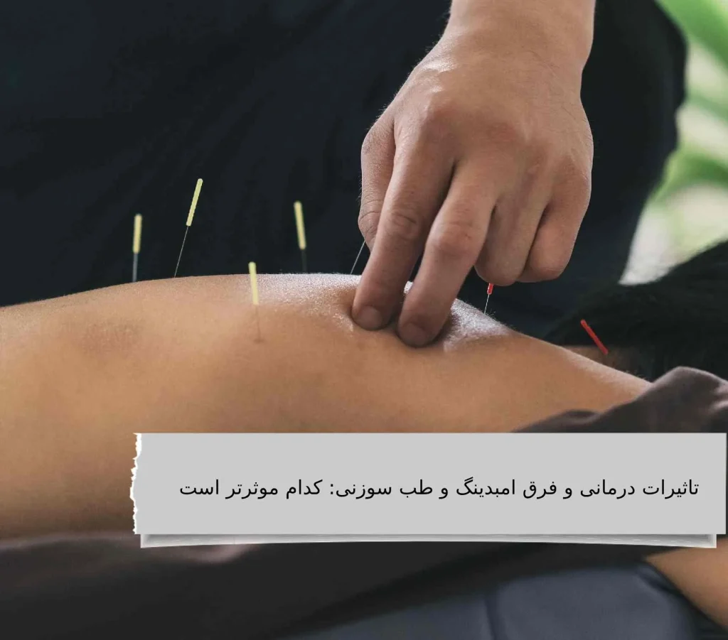 فرق امبدینگ و طب سوزنی