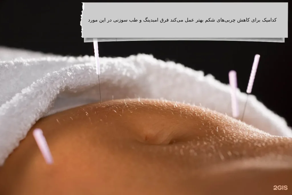 فرق امبدینگ و طب سوزنی