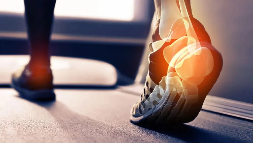 تاندونیت در مچ پا ورزشکار تاندونیت در مچ پا ورزشکار