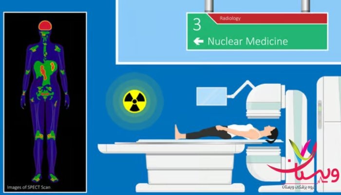 هزینه اسکن هسته ای کل بدن