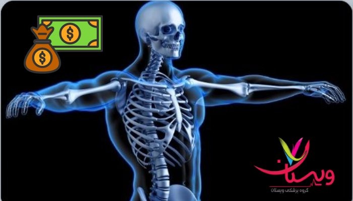 هزینه اسکن هسته ای کل بدن