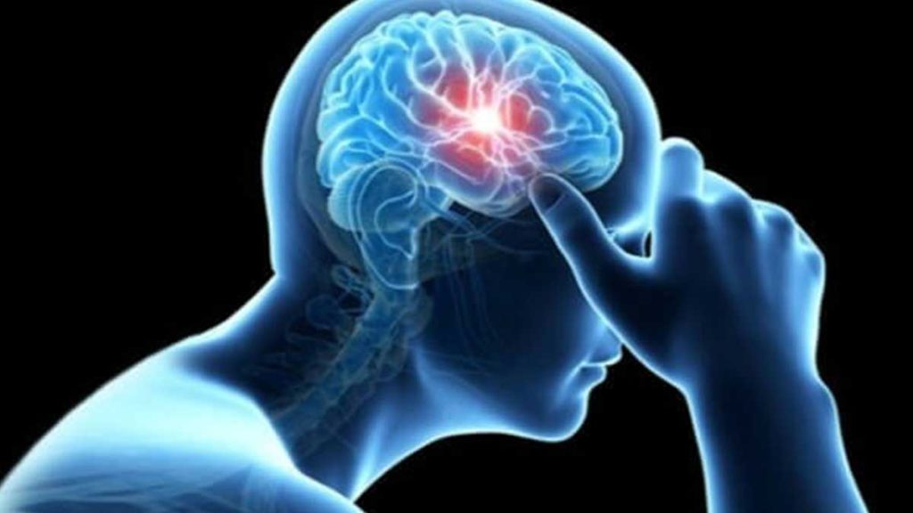 متخصص مغز و اعصاب