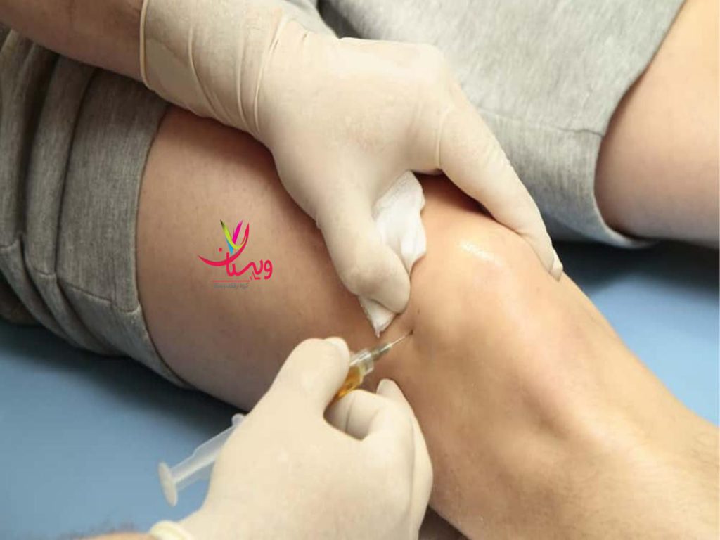 آمپول غضروف ساز Cartilaginous ampoule injection into the knee