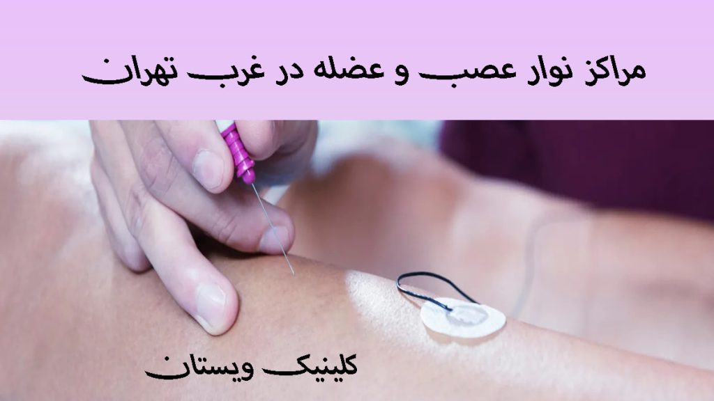 مراکز نوار عصب و عضله یک سوزن نوار عصب و عضله که برای انجام تست روی پای بیمار قرار گرفته است