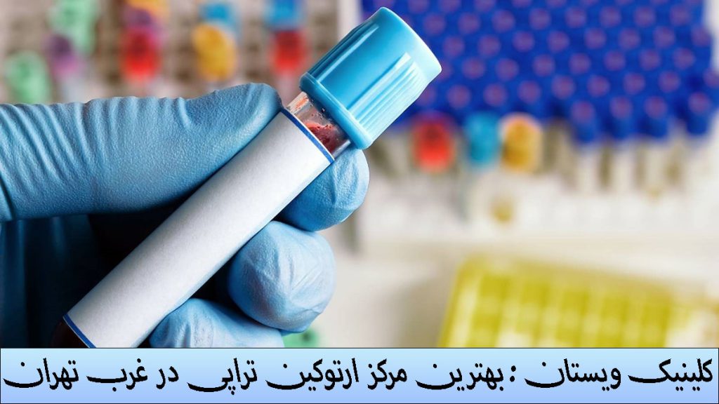 یک ظرف حاوی مواد برای ارتوکین تراپی در دست یک پزشک