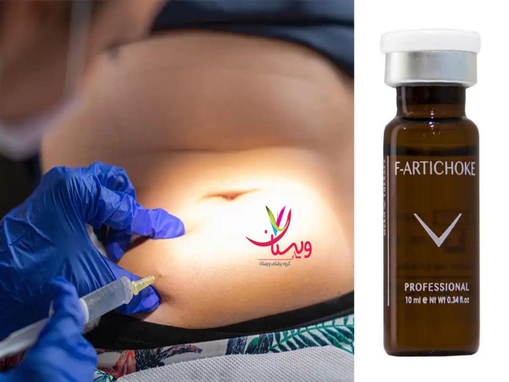 مزوتراپی مزایای مزوتراپی لاغری یا آمپول چربی سوز