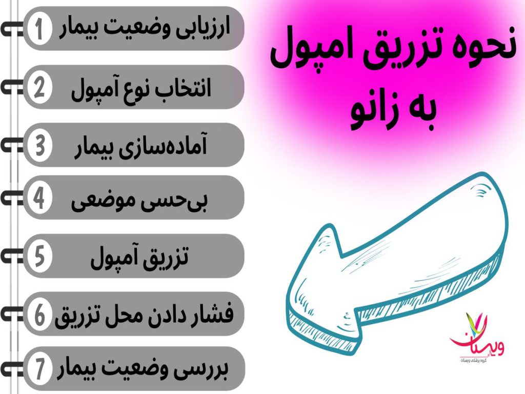 مفصل زانو نحوه تزریق امپول به زانو