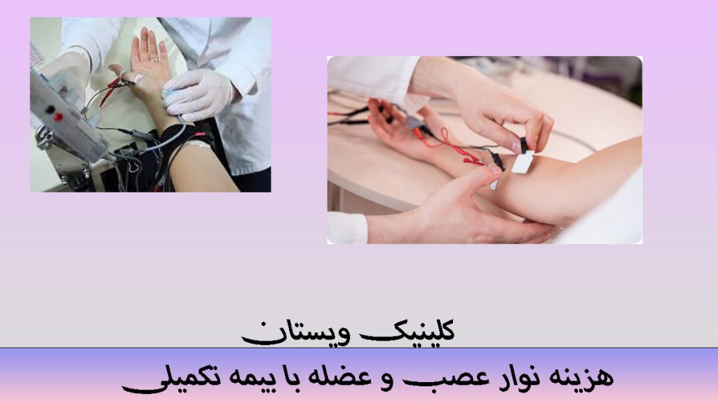 نوار عصب و عضله با بیمه تکمیلی دو تصویر از انجام نوار عصب دست توسط پزشک