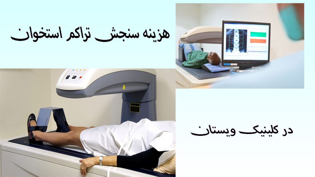 هزینه سنجش تراکم استخوان هزینه سنجش تراکم استخوان - دو تصویر که نشان دهنده نتایج سنجش تراکم استخوان بر روی مانیتور و یک دستگاه سنجش تراکم استخوان است-نوشته با عنوان در کلینیک ویستان