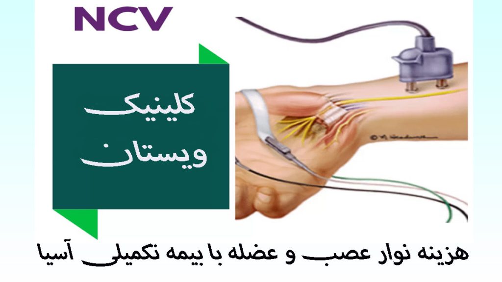 نوار عصب و عضله با بیمه آسیا یک تصویر انیمیشنی از انجام تست نوار عصب و عضله دست-نوشته با عنوان هزینه نوار عصب و عضله با بیمه تکمیلی آسیا