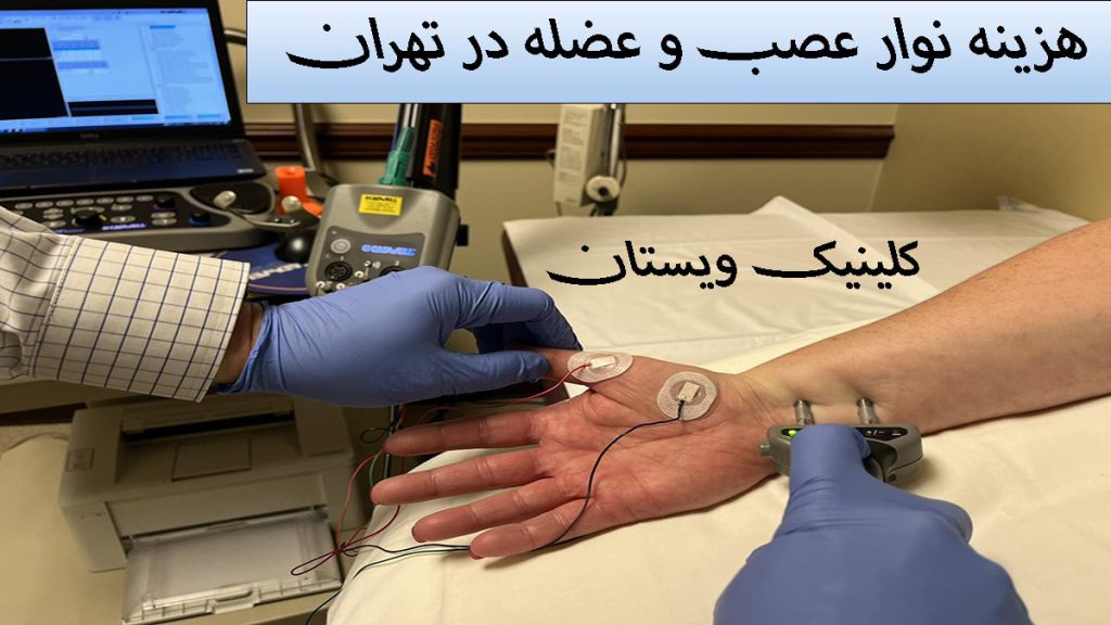 نوار عصب و عضله در تهران پزشک در حال گرفتن نوار عصب دست