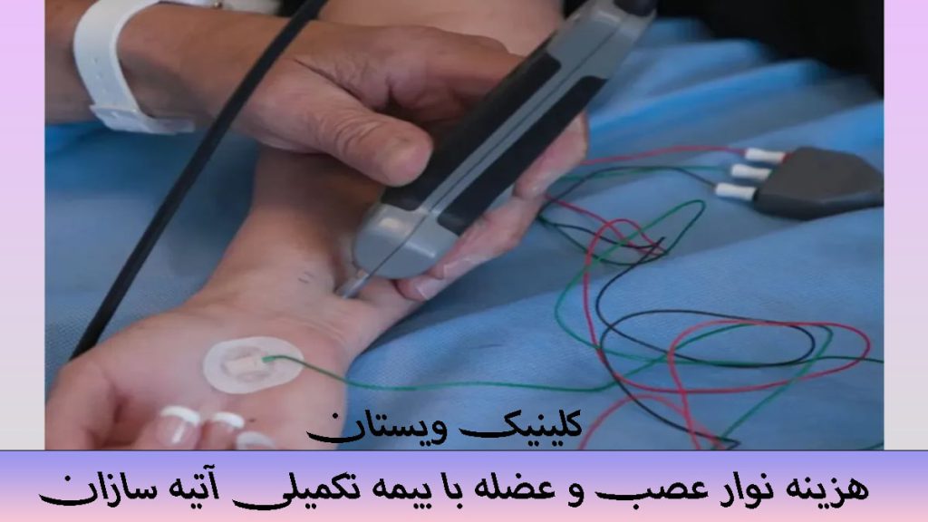 هزینه نوار عصب و عضله یک دستگاه نوار عصب و عضله توسط پزشک روی دست بیمار قرار گرفته است- نوشته با عنوان هزینه نوار عصب و عضله با بیمه تکمیلی آتیه سازان