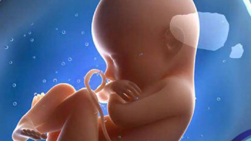 سونوگرافی غربالگری سونوگرافی غربالگری