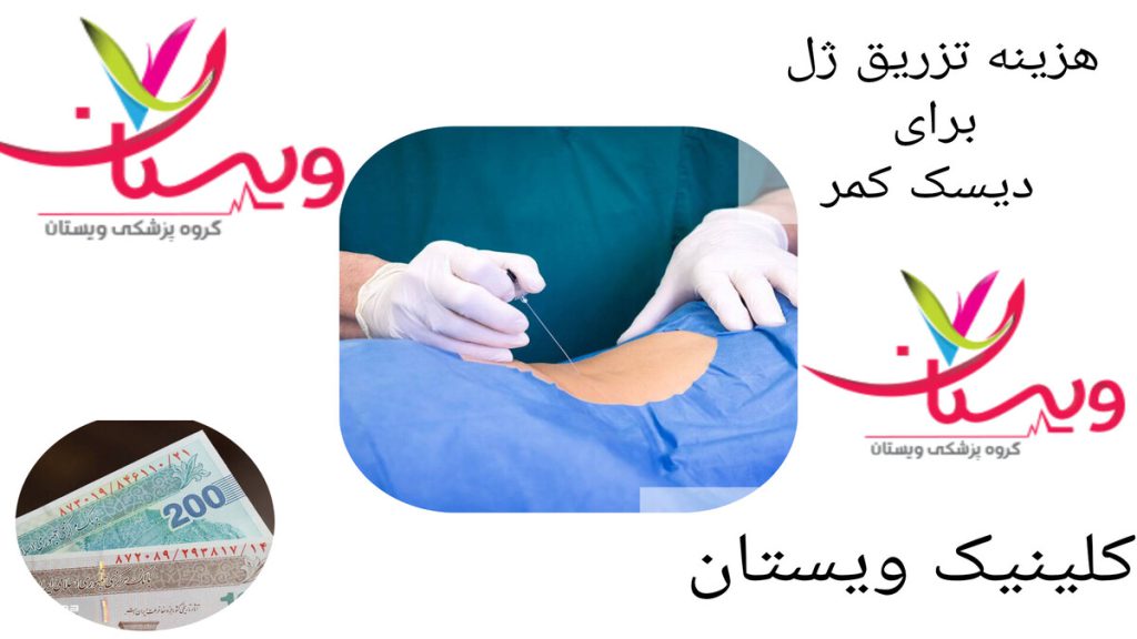 تزریق ژل توسط پزشک و هزینه آن در کلینیک ویستان