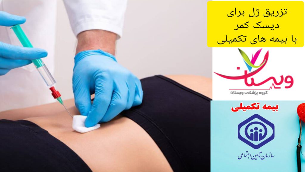 تزریق ژل با بیمه های تکمیلی هزینه تزریق ژل برای دیسک کمر با بیمه های تکمیلی