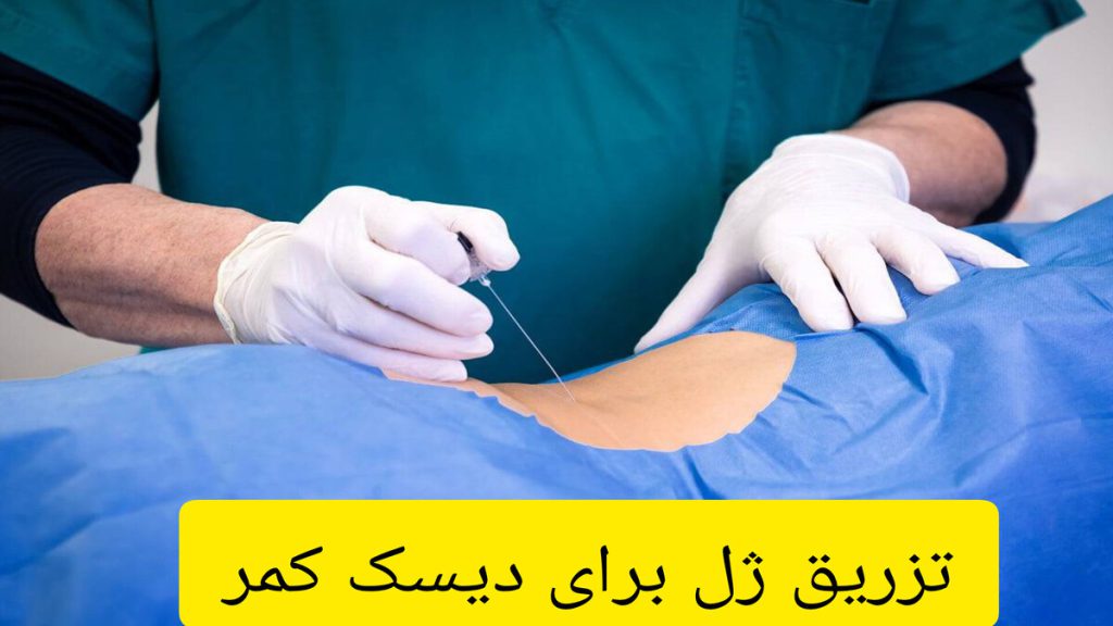 تزریق ژل توسط پزشک پزشک برای کمر بیمار ژل تزریق می کند.