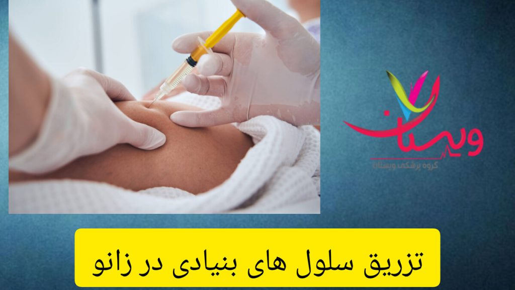 پزشک در حال انجام تزریق سلولهای بنیادی در زانوی بیمار