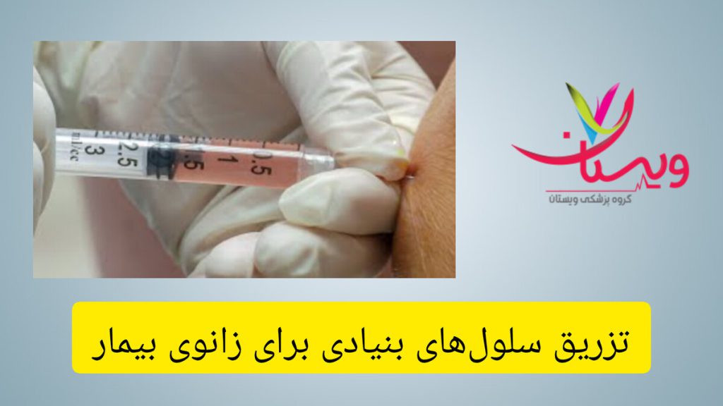 سلول درمانی، راهی نوین برای درمان آسیب های زانو پزشک از تکنیک جدید برای زانوی بیمار استفاده می کند