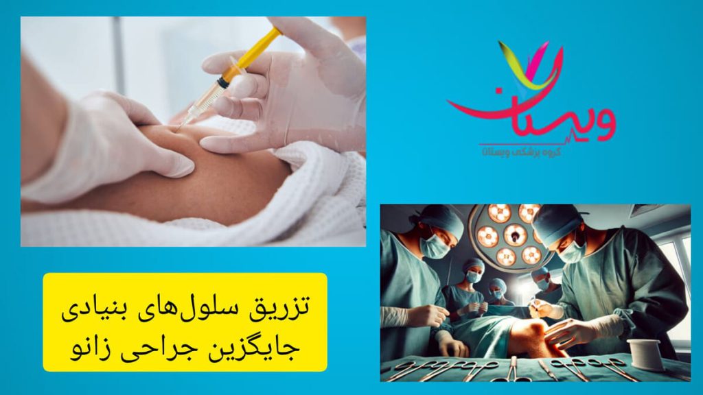 استفاده از سلول های بنیادی در پزشکی ترمیمی زانو پزشک در حال جراحی زانو و یک پزشک در حال تزریق به زانو