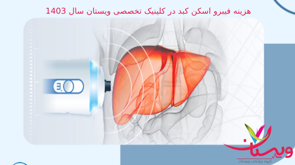 هزینه فیبرو اسکن کبد در کلینیک تخصصی ویستان سال 1403