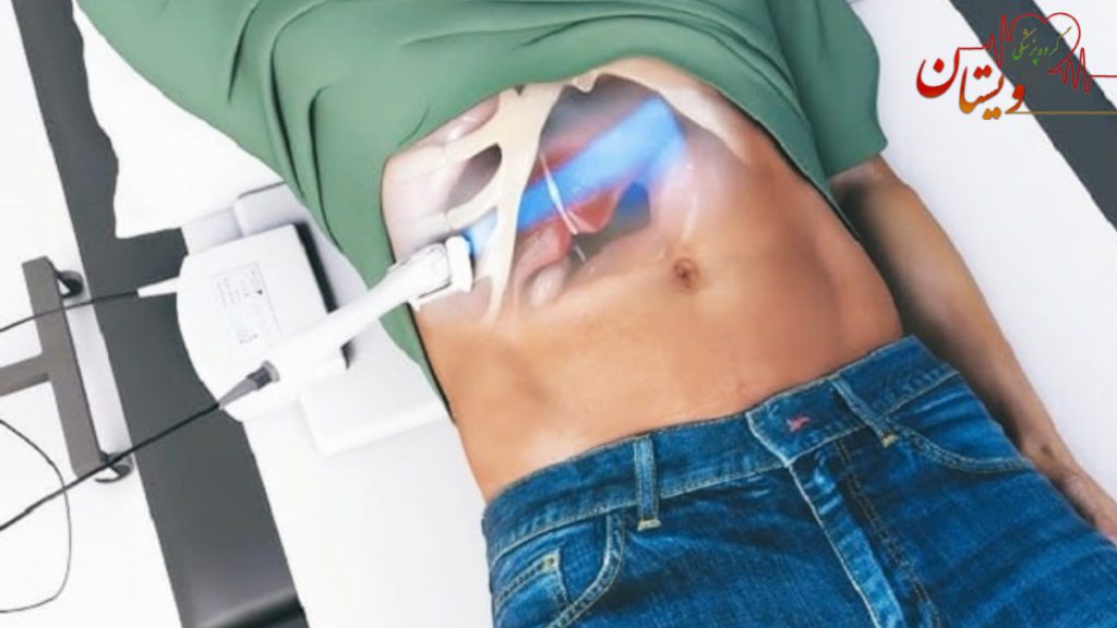 بیمار در حال انجام فیبرو اسکن کبد