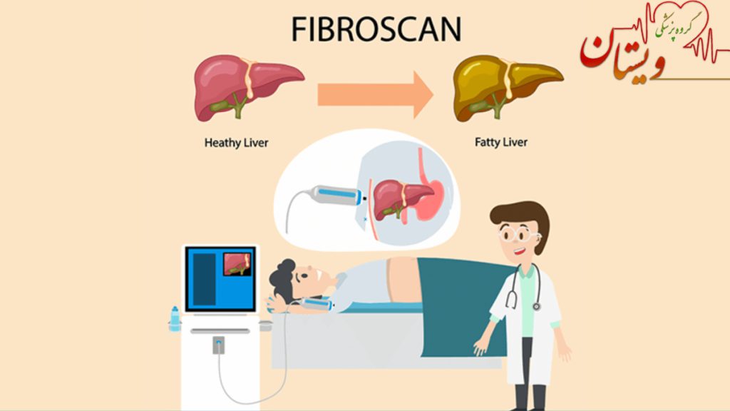 کبد چرب فیبرو اسکن کبد کاملا بدون درد است. یک بیمار در حال انجام فیبرو اسکن کبد با لبخند بر لب