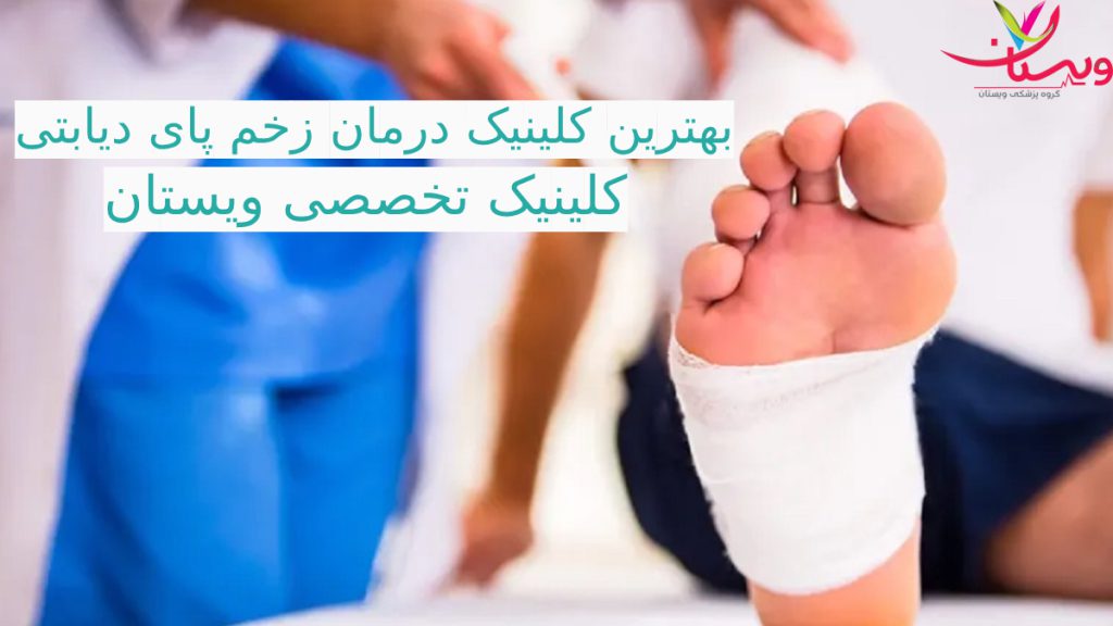 یک بیمار در حال پانسمان زخم پای دیابتی توسط متخصص دیابت