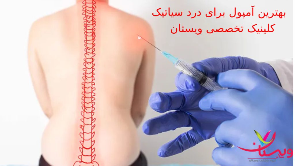 بهترین آمپول برای درد سیاتیک کدام است؟