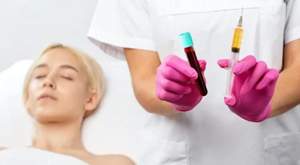 تزریق پلاسمای غنی از پلاکت به صورت