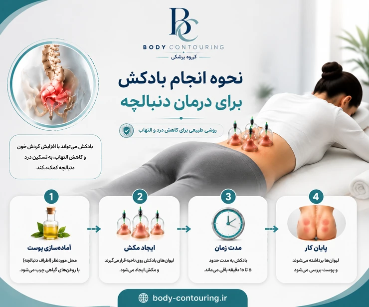 نحوه انجام بادکش برای درمان دنبالچه
