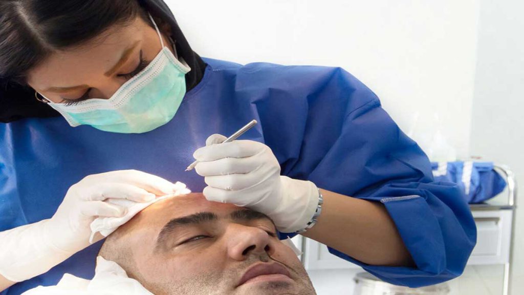 پزشک متخصص پی آر پی در حال تزریق موی سر بیمار است پزشک متخصص پی آر پی در حال تزریق موی سر بیمار است