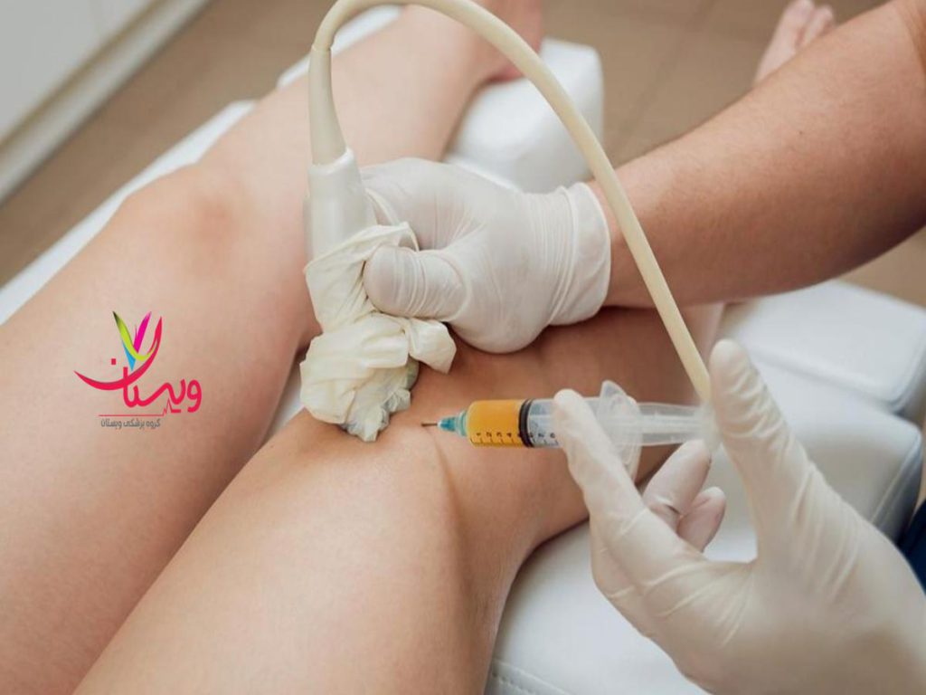 جلسه درمانی پی آر پی نظرات مردم در مورد پی ار پی زانو و کاهش نیاز به جراحی