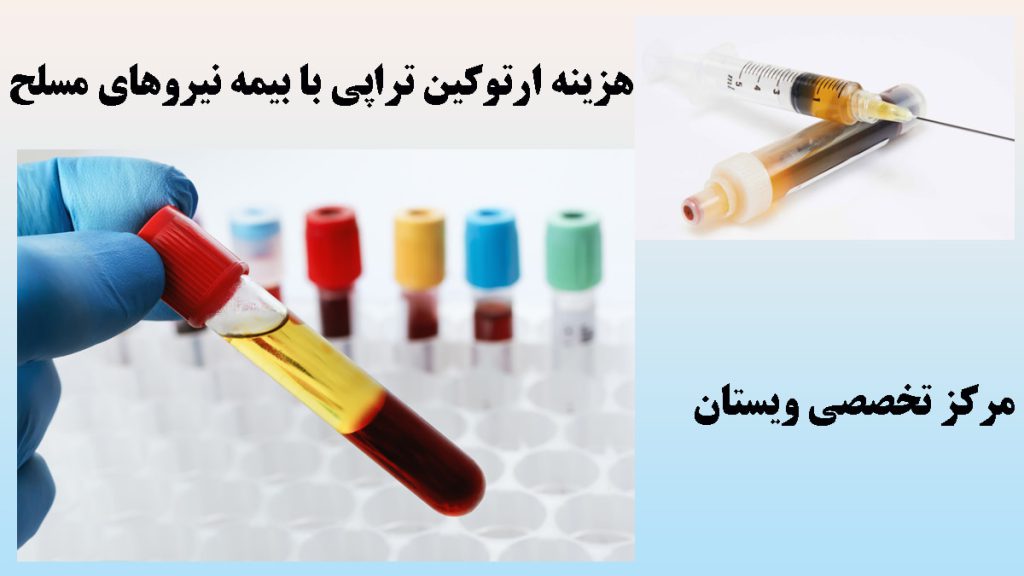 ارتوکین تراپی با بیمه نیروهای مسلح دو تصویر از سرنگ حاوی ارتوکین تراپی