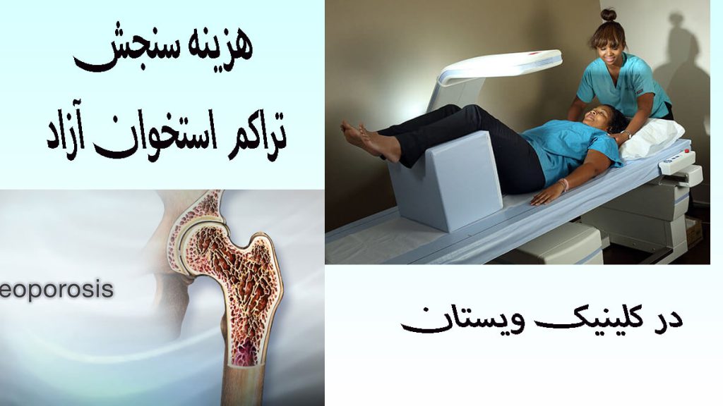 سنجش تراکم استخوان آزاد دو تصویر از سنجش تراکم استخوان