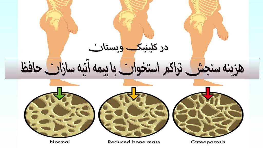 هزینه سنجش تراکم استخوان سه تصویر از بدن انسان که در زیر آنها تراکم استخوان نشان داده می شدو-نوشته هزینه سنجش تراکم استخوان با بیمه آتیه سازان حافظ