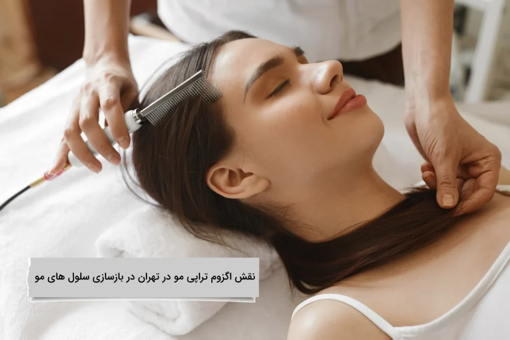نقش اگزوم تراپی مو در تهران در بازسازی سلول های مو نقش کاربردی اگزوم تراپی مو برای بازسازی سلول های مو