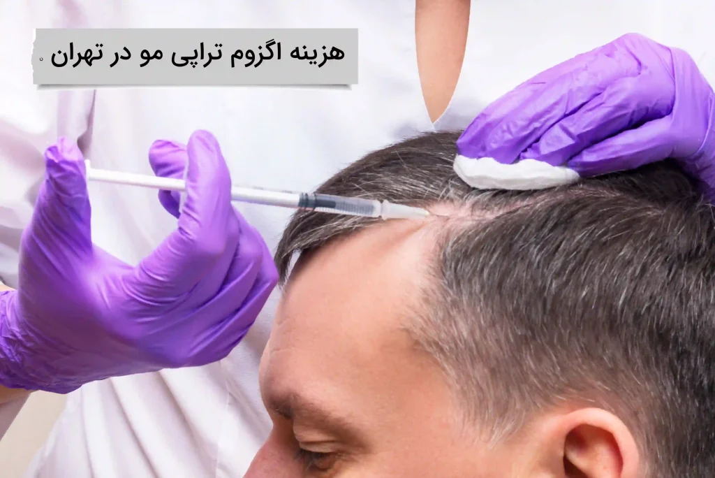 هزینه اگزوم تراپی مو در تهران اکاهی از هزینه اگزوم تراپی مو در تهران
