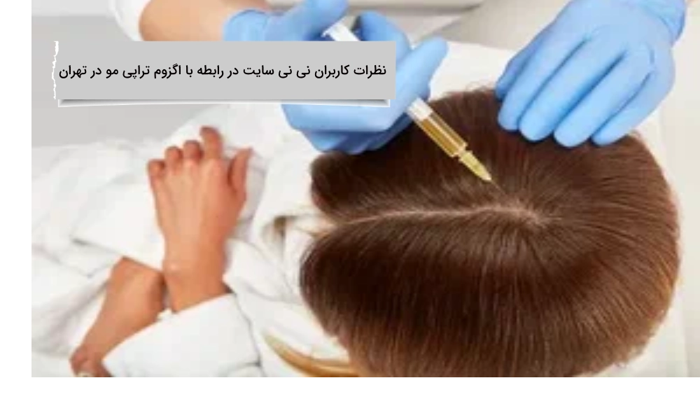 نظرات کاربران نی نی سایت در رابطه با اگزوم تراپی مو در تهران نظرات کاربران نی نی سایت در رابطه با اگزوم تراپی مو در تهران چیست