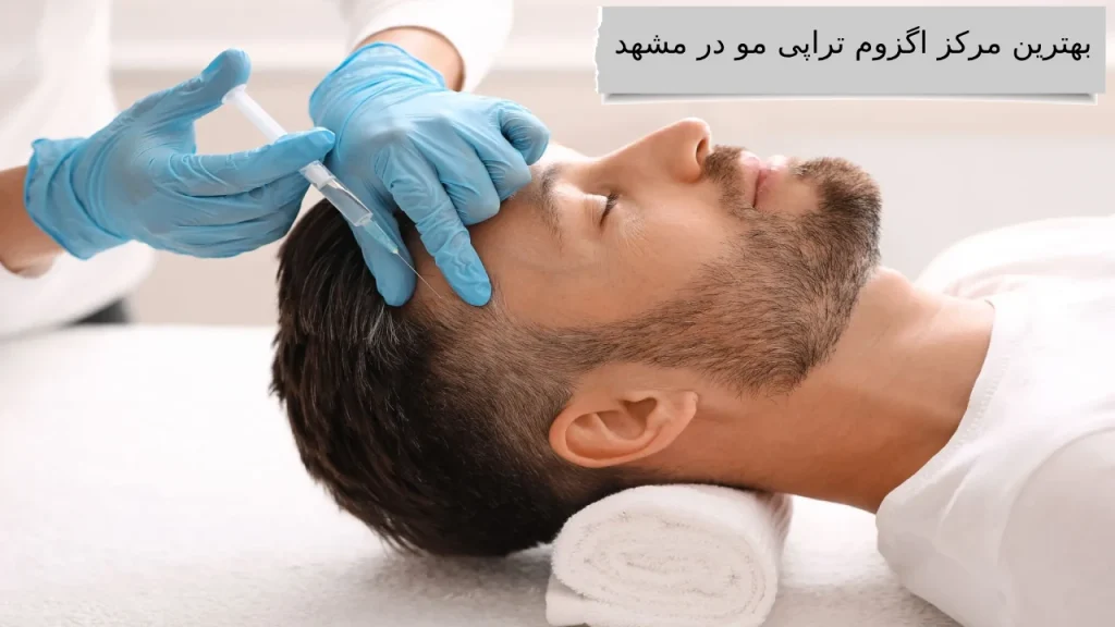 بهترین مرکز اگزوم تراپی مو در مشهد بهترین کلینیک ها برای اگزوم تراپی مو با قیمت مناسب