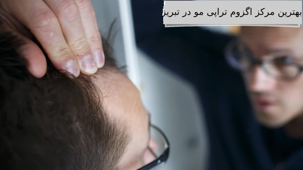 بهترین مرکز اگزوم تراپی مو در تبریز بهترین کلینیک ها برای اگزوم تراپی مو با قیمت مناسب