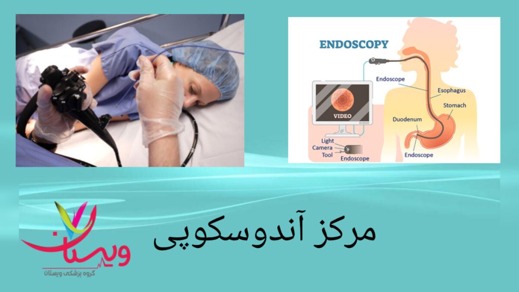 آندوسکوپی در مراکز معتبر انجام اندوسکوپی برای بیمار با بیهوشی