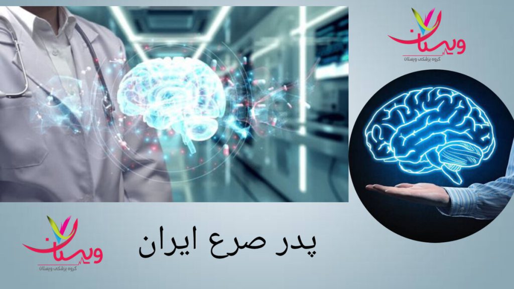 پزشک متبحر در درمان صرع و نمایی از مغز انسان