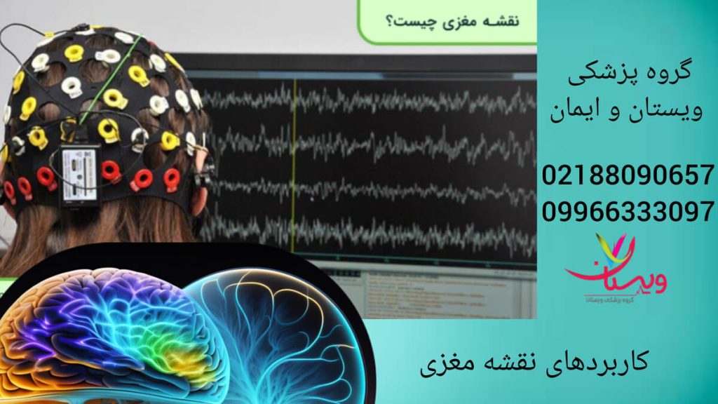 بیمار در حال انجام نقشه مغزی