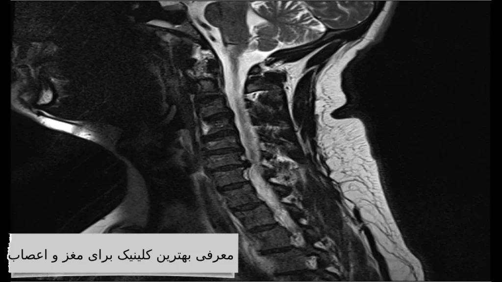 معرفی بهترین کلینیک برای مغز و اعصاب معرفی بهترین دکتر متخصص مغز و اعصاب و گردن درد در کلینیک مجرب